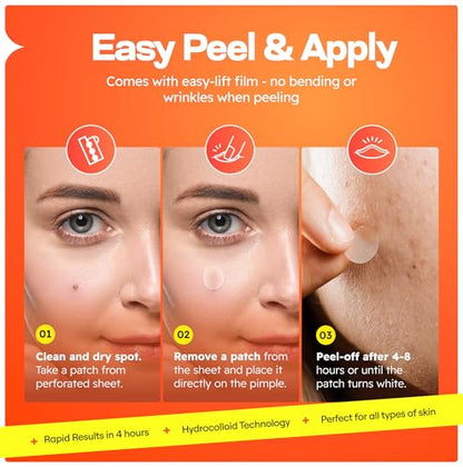 Laveile Spot Patches 150 Count - 4 Sizes Hydrocolloid Pimple Patches for Breakouts - Fast Acting Acne Patches with Salicylic Acid, Tea Tree & Calendula oil - Invisible Spot Dots for Blemishes