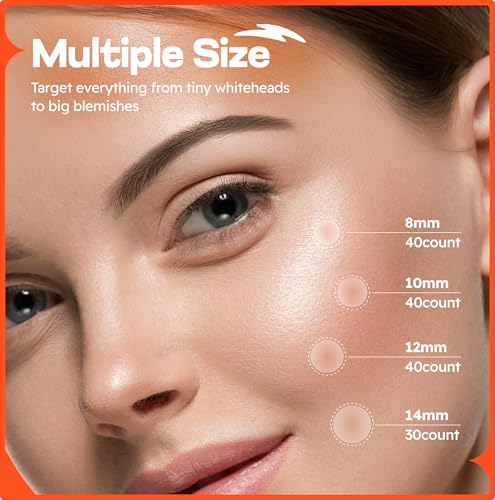 Laveile Spot Patches 150 Count - 4 Sizes Hydrocolloid Pimple Patches for Breakouts - Fast Acting Acne Patches with Salicylic Acid, Tea Tree & Calendula oil - Invisible Spot Dots for Blemishes